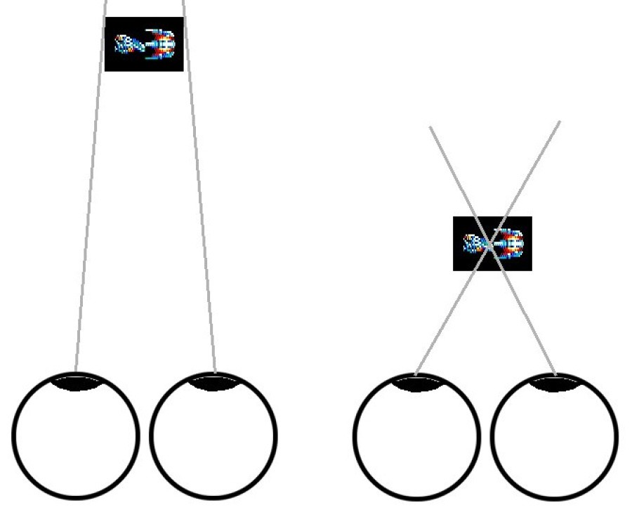 stereopsis.jpg