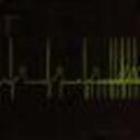 deadbattery