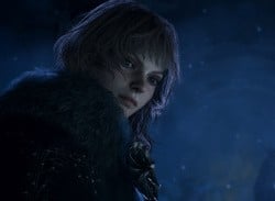 Dragon's Dogma 2 Side-By-Side Graphics Comparison (Switch 2 & PS5)