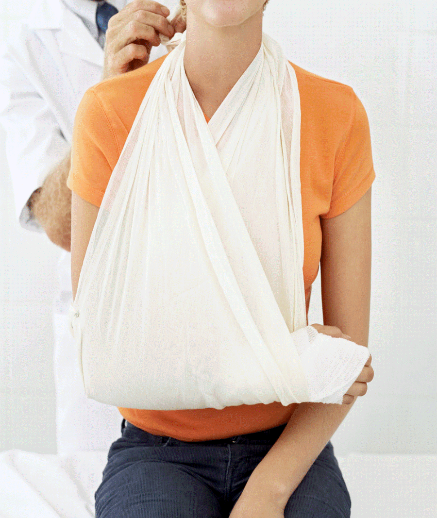 Broken20 Arm