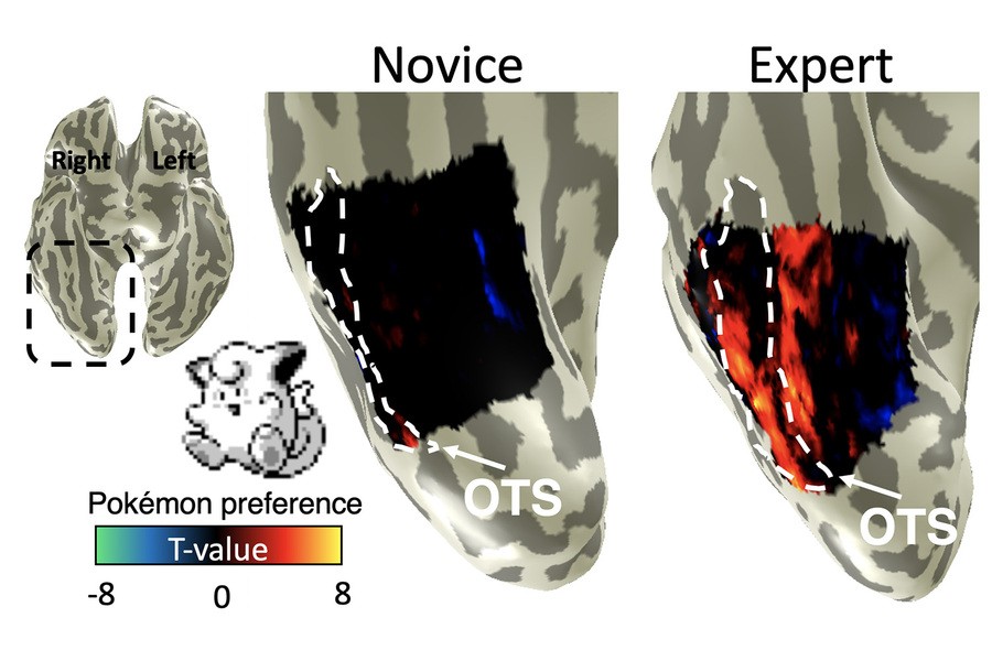 A comparison in brain activity of adults who played Pokémon extensively as children and adults who did not