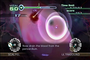 Trauma Center: New Blood Screenshot