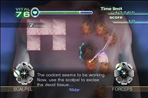 Trauma Center: New Blood Screenshot